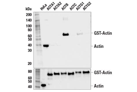 beta Actin Antibody (D6A8) .